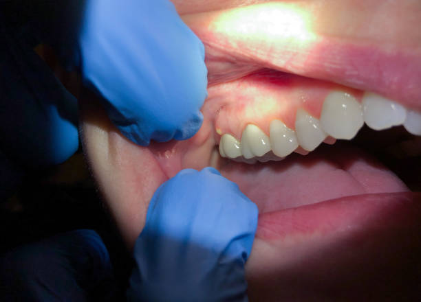 Best Emergency Gum Pain Relief  in Fredericksburg, PA