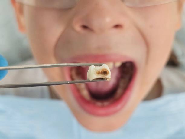 Best Emergency Tooth Extraction  in Fredericksburg, PA